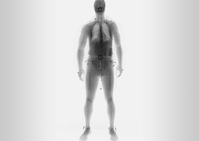 Full Body X-ray FB SCAN