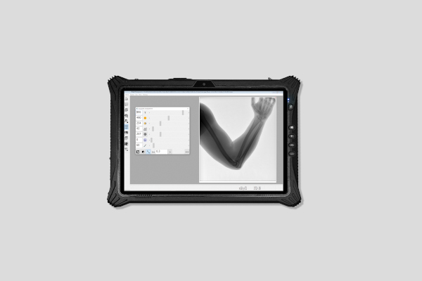 MIRAN Portable X-ray